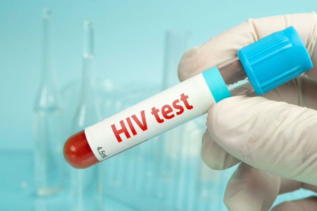 HIV cure breakthrough? Melbourne scientists using mRNA to tackle virus