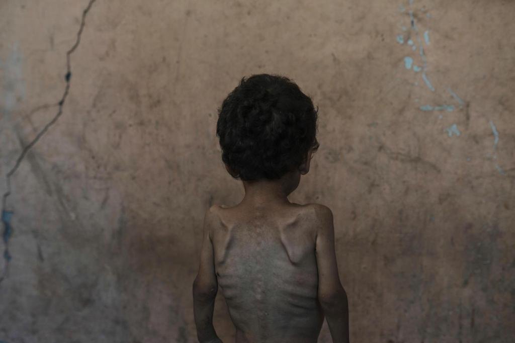 ‘Worst-case scenario of famine’ is happening in Gaza, food crisis experts warn